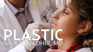 Savannahs Rhinoplasty Surgery Experience  PLASTIC with Dr Dhir [upl. by Allenad]