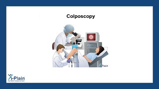 Colposcopy [upl. by Nair]