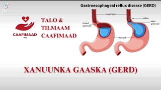 Cudurka Gaaska ama Laabjeexa [upl. by Ajna]