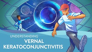 Understanding Vernal Keratoconjunctivitis VKC [upl. by Ludlew]