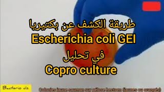 طريقة الكشف عن escherichia coli GEI في تحليل copro culture [upl. by Nicol]