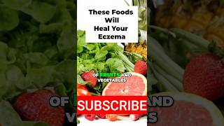 Eat These Foods to Heal Eczema Faster [upl. by Olenka]