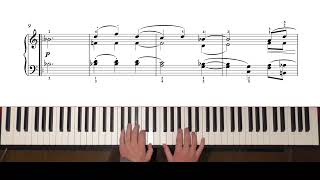 Beethoven  Bagatelles  Op 119 No 8  52000pts [upl. by Marvella]