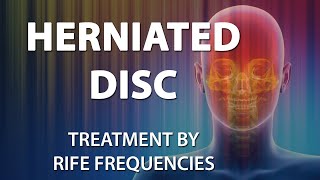 Herniated Disc Disk  RIFE Frequencies Treatment  Energy amp Quantum Medicine with Bioresonance [upl. by Masha218]