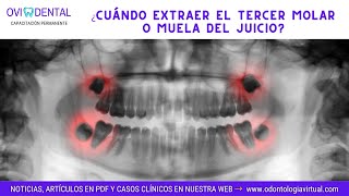 ► PERICORONARITIS ¿Cuándo extraer el tercer molar o muela del juicio [upl. by Nena]