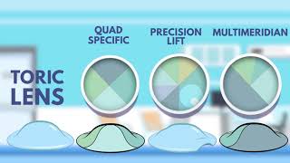 Scleral Contact Lenses for Keratoconus and Hard to fit Eyes [upl. by Eiryt780]