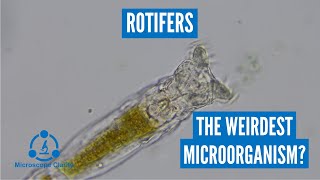 Rotifers under the microscope these things are so weird [upl. by Anelac]