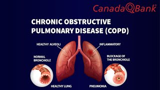 Chronic Obstructive Pulmonary Disease COPD [upl. by Zebe]