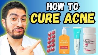 99 Overlook These Effective Acne Treatments – 2024 Guide [upl. by Croom]