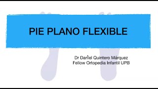 Pie plano flexible [upl. by Sumner]