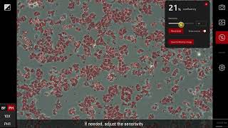 Confluency measurement with the Mateo TL microscope [upl. by Egan]