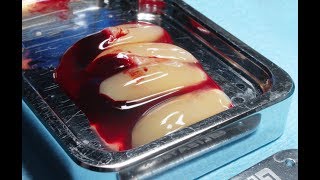 Clinical Applications of Autologous Blood Concentrates [upl. by Aserej]