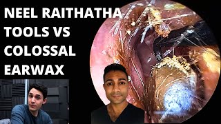 The Neel Raithatha Tools VS Colossal Earwax Blockage First Impressions [upl. by Kcirted606]