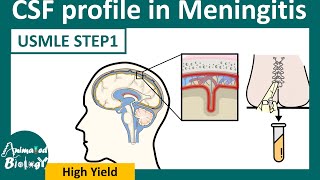 CSF analysis in Meningitis  Easy way to remember CSF analysis in meningitis flow chart [upl. by Alleb]