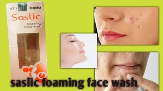 Saslic foaming face wash uses sideeffects saslic face wash benefits sasilic face for pimple [upl. by Nimra]