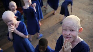 Albino People Hunted In Tanzania [upl. by Dav902]