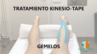 Aplicación del kinesiotape en gemelos [upl. by Cari]