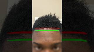 How to Prevent PUSHING BACK a Hairline [upl. by Adair]