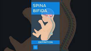 Spina bifida offener Rücken Definition  Kenhub spinabifida [upl. by Ynaffik538]