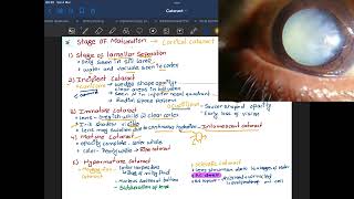 senile cortical cataract  Stage of maturation of senile cortical cataract amp Nuclear cataract [upl. by Grantley481]