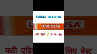 Lichensa ointment cream  का उपयोग हिंदी में medical drx doctor dpharma bpharma bams nursing [upl. by Wheaton]