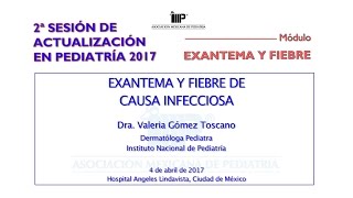 Exantema y fiebre de causa infecciosa [upl. by Elladine376]