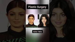 Plastic Surgery Face of  anushkasharma katrinakaif priyankachopra shraddhakapoor dishapatani [upl. by Estell217]