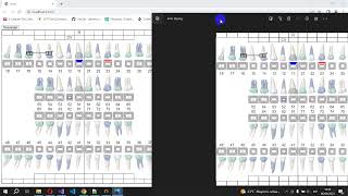 Simulación de odontograma con HTML y Javascript [upl. by Rentsch]