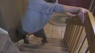 LimbGirdle Muscular Dystrophy 2A Stair Climbing Part 1 [upl. by Zingale934]