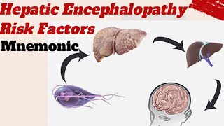 Hepatic Encephalopathy Risk factors Mnemonic [upl. by Sparky]