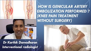 HOW IS GENICULAR ARTERY EMBOLIZATION PERFORMED  KNEE PAIN TREATMENT WITHOUT SURGERY [upl. by Asimaj]