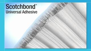 Scotchbond™ Universal Adhesive Introduction [upl. by Anait675]