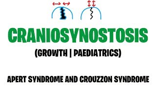 CRANIOSYNOSTOSIS  PAEDIATRICS  GROWTH  APERT SYNDROME  CROUZZON SYNDROME  MEDVIDSMADESIMPLE [upl. by Yerffe306]