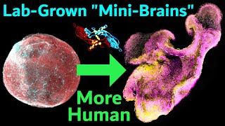 New Technique Makes Brain Organoids More Like Real Human Brains Expanded Neuroepithelium Organoids [upl. by Quartis252]