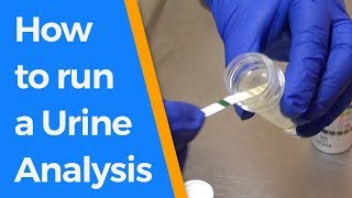 How to run a Urine Analysis [upl. by Bourke]