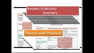 Amoebic Dysentery versus bacillary dysentery [upl. by Nayve863]