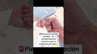 Piel seca en recién nacidos  ¡Es completamente normal❗️pregnancy newborn firsttimemoms [upl. by Earlie144]