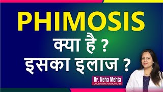 What is Phimosis and its Treatment in Hindi  Dr Neha Mehta [upl. by Lerrud960]