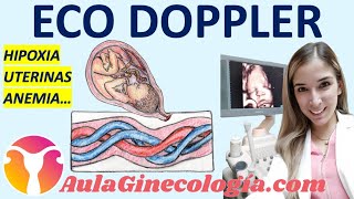 ECO DOPPLER EN OBSTETRICIA HIPOXIA ARTERIAS UTERINAS ANEMIA FETAL  Ginecología y Obstetricia [upl. by Amelia]