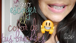 COMO ESCOGER EL COLOR DE TUS LIGAS DE BRACKETS [upl. by Annayd491]