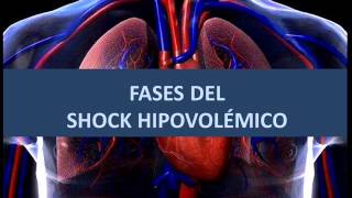 Fases del shock hipovolémico [upl. by Brahear92]