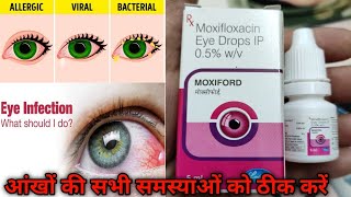 Moxiford Eye Drop Review  Moxifloxacin  Uses and Benefits  And How To Use  In Hindi [upl. by Llertnac517]