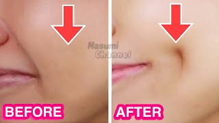 How To Get Dimples Fast amp Naturally Simple Facial Exercises to get Dimples without Surgery [upl. by Ecnatsnok311]