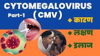 Cytomegalovirus  CMV  Positive l कारण । लक्षण । और इलाज l Part1 [upl. by Eilrebmik]