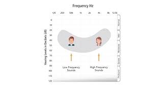 Understanding an Audiogram [upl. by Moriarty]