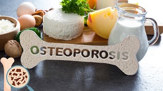 Osteoporosis  Everything You Need To Know [upl. by Ennazus546]