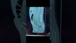 ¡IMPRESIONANTES CASOS RADIOLÓGICOS radiologia medico radiology [upl. by Pergrim]