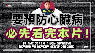 檢查心臟之前必須搞清楚的幾件事！ct angiogram  something I wish I knew before the test [upl. by Salokcin]