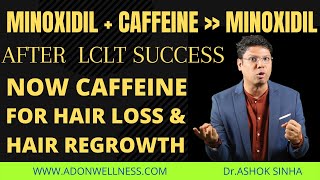 Caffeine Powder After LCLT Success For Hair Loss amp Hair Regrowth  Dr Ashok Sinha [upl. by Lyrej]