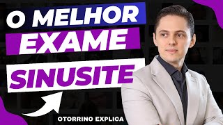 ➡️EXAME PARA A SINUSITE  QUAL O MELHOR  OTORRINO EXPLICA [upl. by Ellennaj]